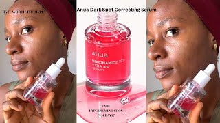 Sérum Anua, la solution idéal pour les acnés, tâches, rougeurs et une peau du visage lisse et éclatante
