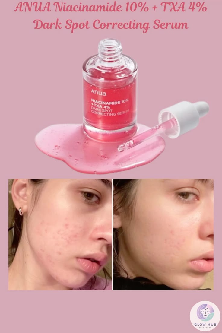 Sérum Anua, la solution idéal pour les acnés, tâches, rougeurs et une peau du visage lisse et éclatante