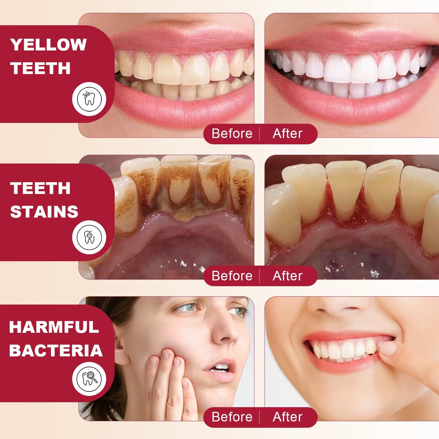 Dentifrice Blanchissant ELAIMEI SP-4 Ultra+, Sourire éclatant, des dents saines et blanches en quelques jours seulement