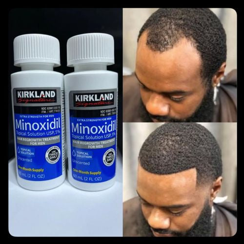 Solution anti-chute et pousse barbe, cheveux rapide et efficace nº1 mondial des produits pousse cheveux, kirkland Minoxidil 5% original